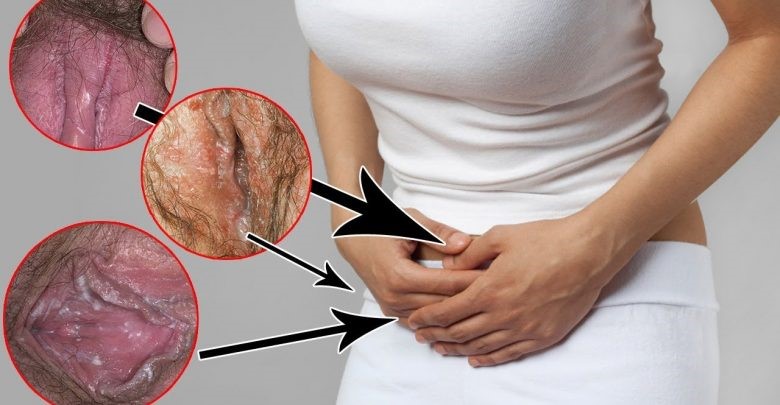 پلاسما تراپی واژن چگونه انجام میشود؟